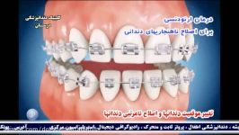 درمان ارتودنسی،اصلاح ناهنجاری های دندانی