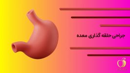 روش عمل جراحی حلقه گذاری معده