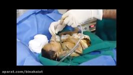 نجات نوزاد تازه متولد شده ثانیه های حیاتی شروع زندگی