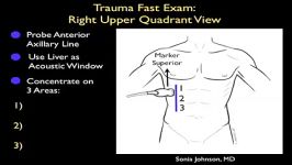 ارزیابی تروما سونوگرافی FAST RUQ Exam  خونریزی