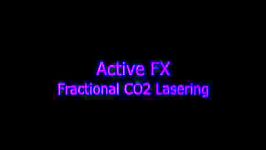 Active FX Fractional CO2 Laser