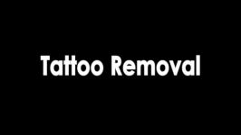 SPECTRA Tattoo Removal  Fastest Q Switched Laser Available 5 7ns  Highest Peak Power