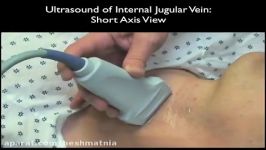 Ultrasound Guidance for Central Venous Access  Part 1