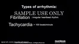 آریتمی قلبی cardiac arrhythmia
