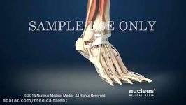 شكستگی قوزك پاAnkle Fracture