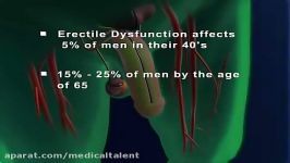 اختلال نعوظErectile Dysfunction