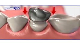 آشنایی درمانهای مختلف دندانپزشکی