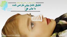 متد خارق العاده جراحی زیبایی به تازگی وارد ایران شده