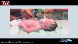 کپسول اکسیژن جان یک نوزاد را گرفت