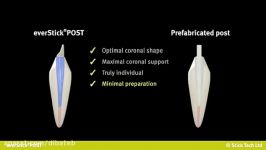 GC everStick Post نوار فایبر گلاس نوری