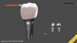 Customized abutment