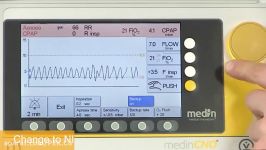 medinCNO® ventilation modes NIPPV