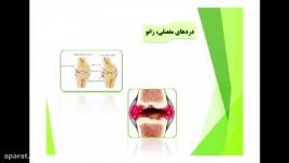 مشکلات مفصلی آرتروز دکتر فاطمی مهر