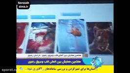 هفتمین کنگره بین المللی قلب عروق رضوی شبکه چهار سیما