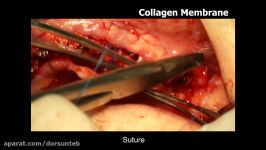 OSTEON Collagen Collagen membrane