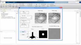 فیلم پروژه تشخیص فاصله قرنیه عدسی MATLAB