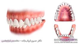 ارتودنسی فاصله بین دندان ها  دکتر حسین ارباب زاده