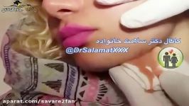 خارج کردن غده چرکین صورت دختر