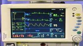 fiberoptic intubation ETT