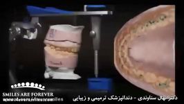 اصلاح طرح لبخند  دکتر نهال سناوندی