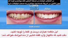 هشدار تبلیغ لوما اسمایل luma smile یك فریبكارى است