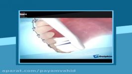 tooth brushing in orthodontic اموزش بهداشت در ارتودنسی