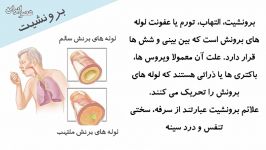 درمان های خانگی موثر برونشیت