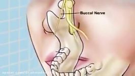 Standard Inferior Alveolar Nerve Block