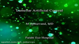 Lamellar Artificial Corneal