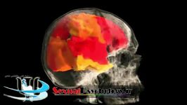 نگاهی به مغز یک خانم در هنگام ارگاسم در زیر دستگاه MRI