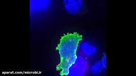 سلول کشنده T درحال نابود کردن یک سلول سرطانی