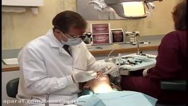 Live patient Direct Composite Veneers