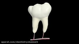 آناتومی سه بعدی آبسه دندان