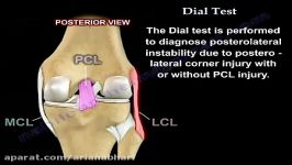 برخورد آسیب های زانو  رباط صلیبی خلفی PCL