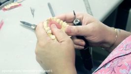 روش ساخت تک دندان آکریلی