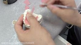 روش ساخت سریع ساده تک دندان آکریلی