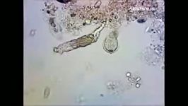 بایوفلوک Protozoa in Activated Sludge