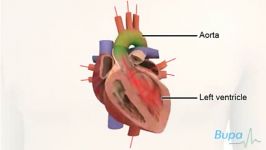 Heart valve repair surgery