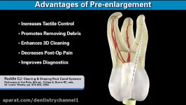 ProTaper Gold  Shaping the Future of Endodontics