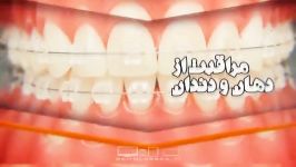 بازکردن چیزی دندان مضرات آن بهداشت دندان