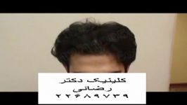 کلینیک کاشت موی دکتر رضائی کلینیک مو ایران 2