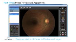Optovue iCam Instructional Video 3