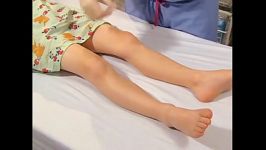 Intraosseous Catheter Placement in Children