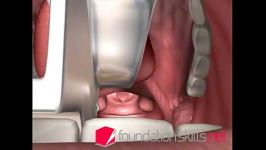 Intubation during General Anaesthesia