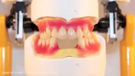 Ivoclar Vivadent BPS Complete Dentures