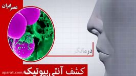 امید به مبارزه ابرباکتری ها کشفیات در بینی انسان