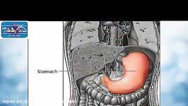 فیلم آموزشی زخم معده عوارض آن