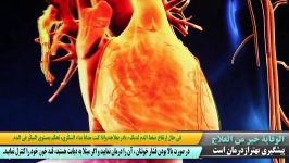 مقدمه تنگی سرخرگهای کرونری قلب 1