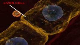 Hepatitis C Infection  3D Medical Animation