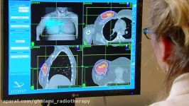 CyberKnife for Breast Cancer